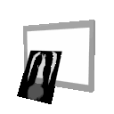 Dessin animé d'une radiographie pulmonaire. Commentaire Tobacostop : Dicton fumeux : <i>À poumons gris, cancer mausade...</i>